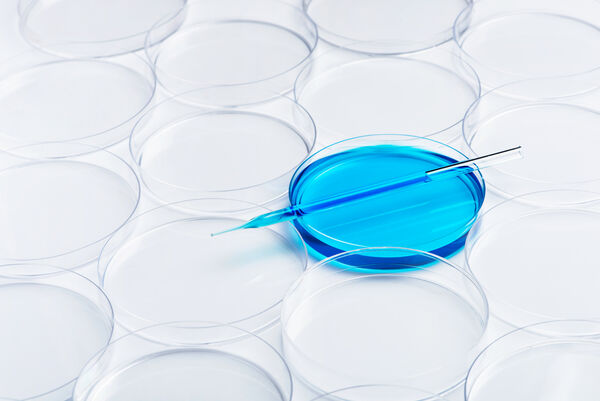 Cultivos de células azules en laboratorio en una placa de Petri